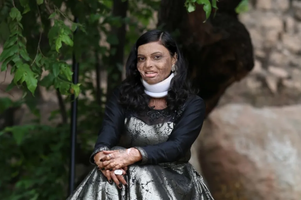 What Fire does not Destroy, it Hardens!!!